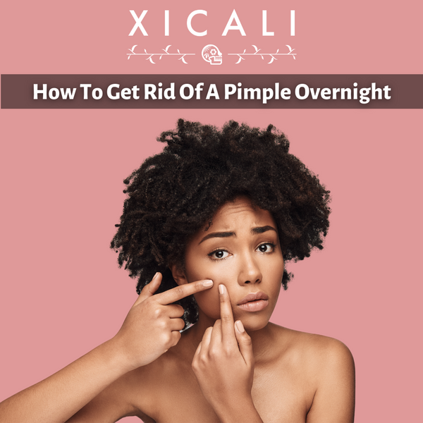How To Get Rid Of Acne Overnight in 6 Steps